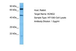 Kv6.2 Rabbit anti-Human, Polyclonal, Novus Biologicals 0.1ml; Unconjugated:Antibodies,